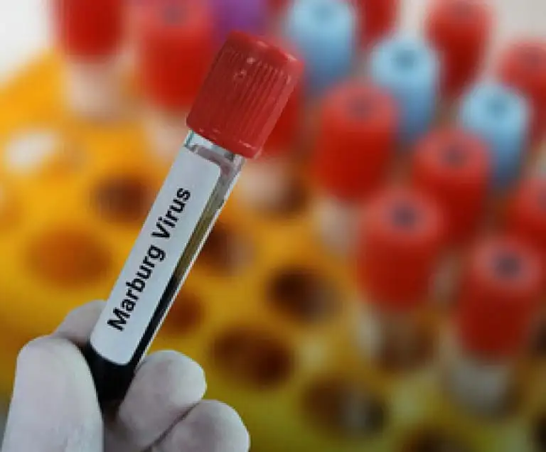 The Importance of Sleep: Tips for Better Rest and Recovery